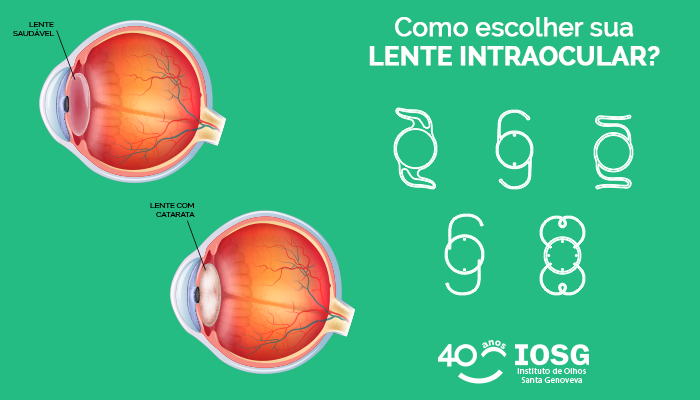 Saiba que tipo de lente oftalmológica escolher!